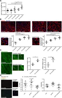 Altered Glycosylation in the Aging Heart